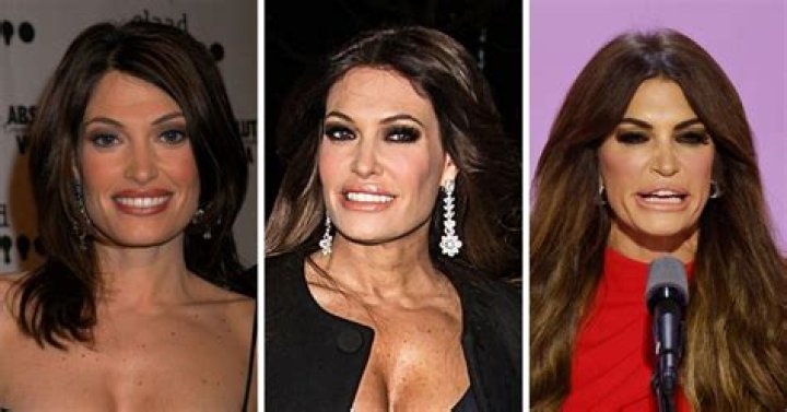 Kimberly Guilfoyle: Young Vs Now - A Transformative Journey