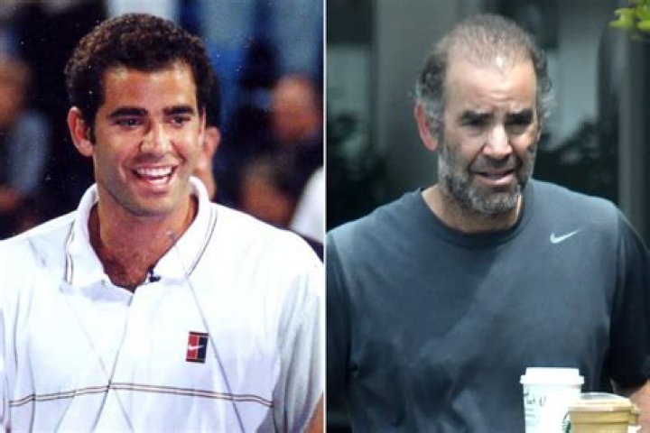 Sam Sampras: The Legend Of Tennis