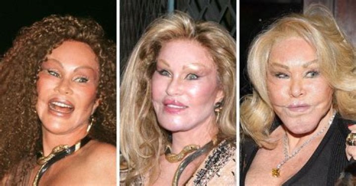 The Enigmatic Transformation Of Jocelyn Wildenstein: A Journey Of Excess And Controversy