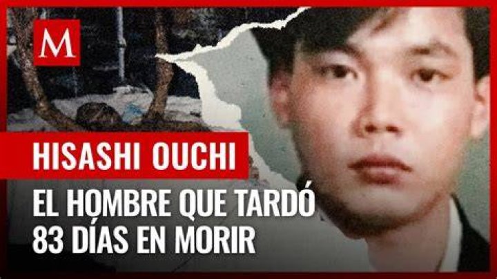 The Tragic Story Of Hisashi Ouchi: Understanding The Death Photos
