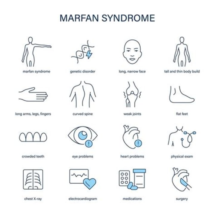 Understanding Barron Trump's Marfan Syndrome: Symptoms And Treatments