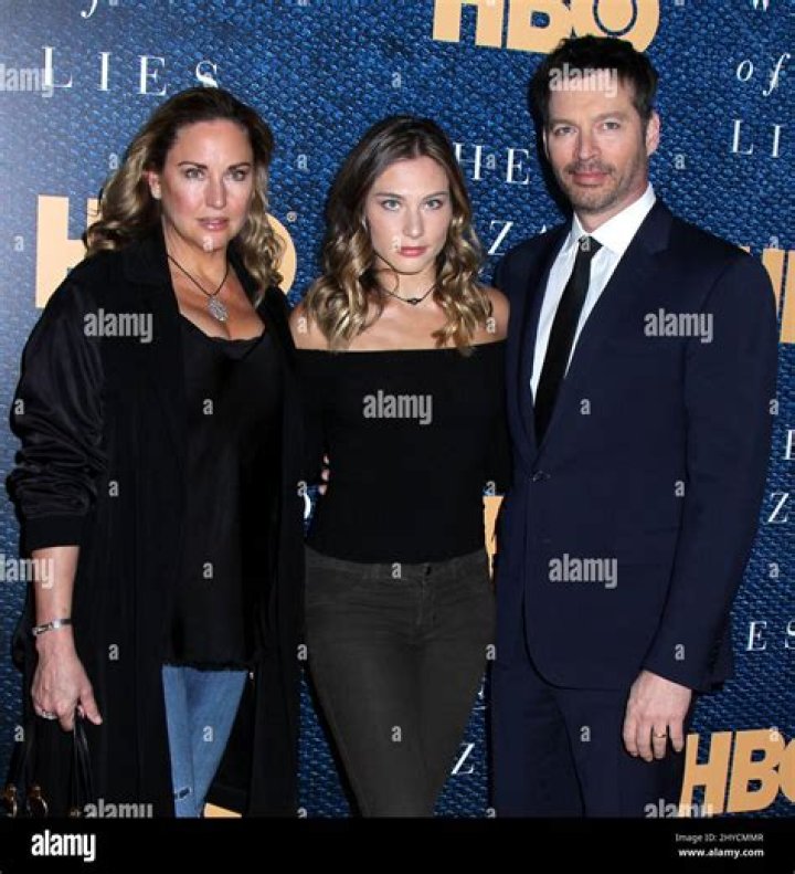 Unveiling The Truth: Does Harry Connick Jr. Have A Scar On His Face?